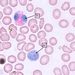 Krev: leukocyty – eosinofil + lymfocyt