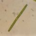 Pleurotaenium ehrenbergii (BRÉB.) DE-BARY