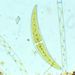 Closterium sp. NITZSCH ex RALFS  2