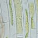 Mougeotia sp. AGARDH