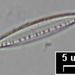 Nitzschia dissipata (KÜTZ.) GRUN.