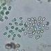 Aphanothece stagnina (SPRENGEL)