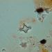 Fragilaria construens f. construens (EHR.) HUSTED