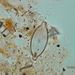 Navicula constats var. symmetrica HUSTED