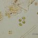 Oocystis marssonii LEMM.