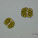 Cosmarium botrytis MENEGH.