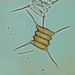 Desmodesmus opoliensis (P. RICHTER) E. HEGEWALD 